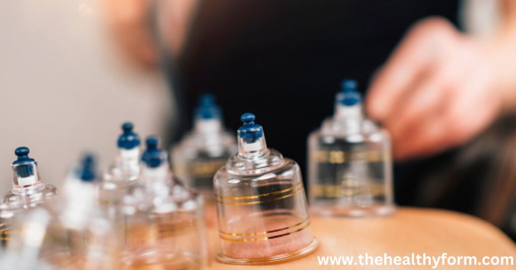 Benefits of Cupping Therapy